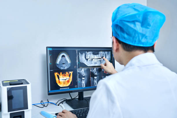 Best Emergency Treatment for Dental Infections or Abscesses in Fort Myers, FL